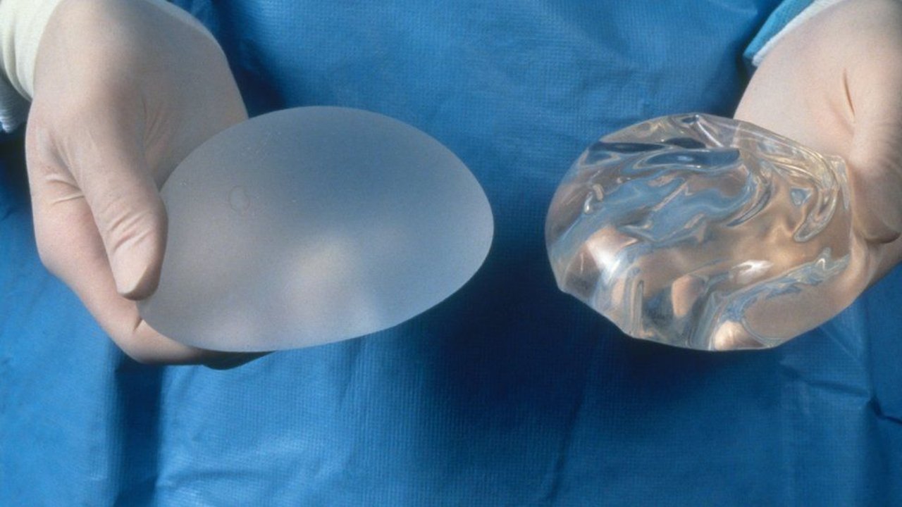 Why Choose Legensilico Silicone Implants